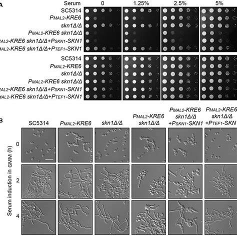 Growth And Cell Morphology Of C Albicans Strains Of The Indicated Download Scientific Diagram