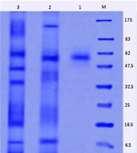 Sds Polyacrylamide Gel Electrophoresis Of The Purified Enzyme M