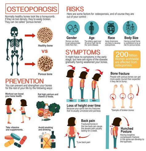 Risk Factors And Precautions For Osteoporosis - Ask The Nurse Expert