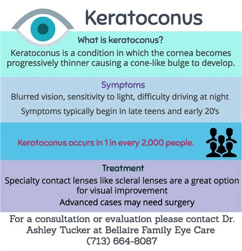 What is Keratoconus? | Bellaire Family Eye Care