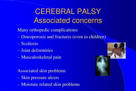 PPT CEREBRAL PALSY An Integrated Approach PowerPoint Presentation