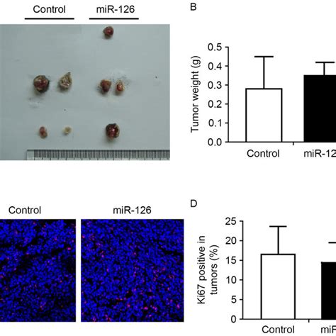 Mir Inhibits The Emt Of Lung Cancer Cells In Vitro A Spc A Lung