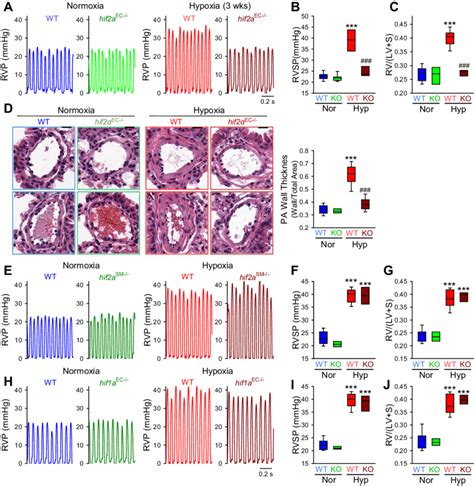 Endothelial Specific Deletion Of Hif2 Attenuates Hypoxia Induced