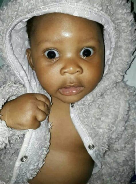 Woman Pours Hot Water On Step Sister In Kogi Disturbing Photo Crime Nigeria