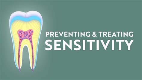 Causes Of Tooth Sensitivity Youtube