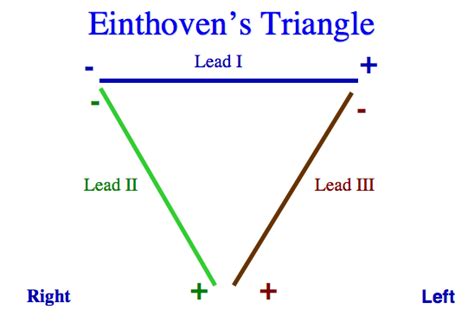 Einthovens Triangle