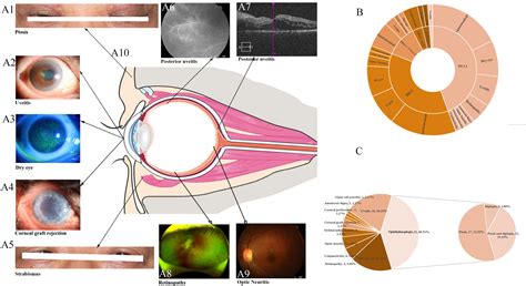 Frontiers Ocular Immune Related Adverse Events Associated With Immune