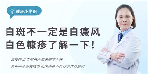 北京国丹医院雷安萍医生分享：白斑不一定是白癜风，白色糠疹了解一下！ 哔哩哔哩