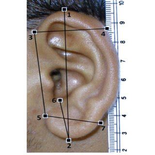 PDF Anthropometric Study Of The External Ear And Its Applicability In Sex Identification