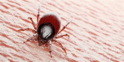 Tick Feeding On A Human Photograph by Sebastian Kaulitzki/science Photo ...