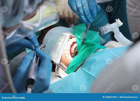 Dental Services For A Child Under General Anesthesia Treatment Of Baby