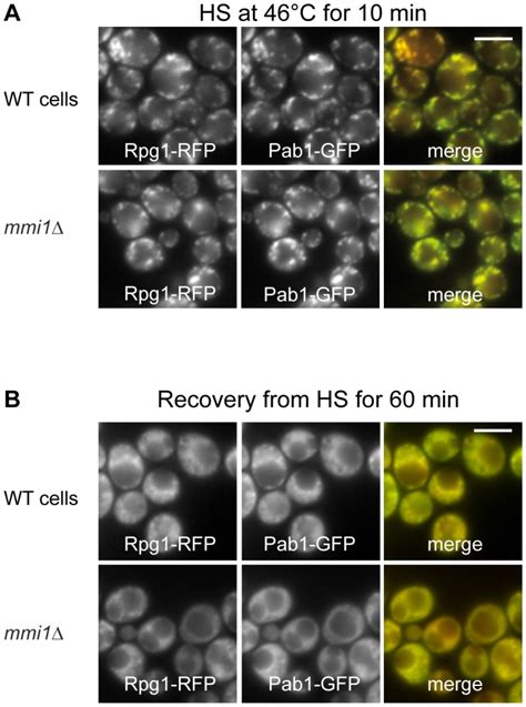 We Compared The Distribution Of Stress Granules Markers Pab Gfp And