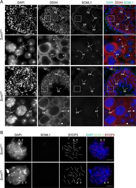 Scml Is Not Detectable In The Nucleus Of Spermatogenic Cells Of