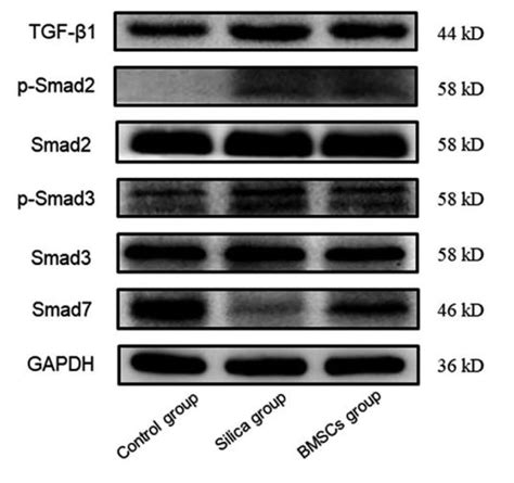 Phospho Smad3 Ser425 Antibody Affinity Biosciences LTD 亲科生物官网