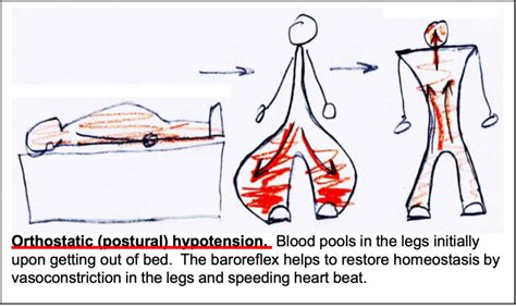 Orthostatic Hypotension Autonomic Nervous System Physiology