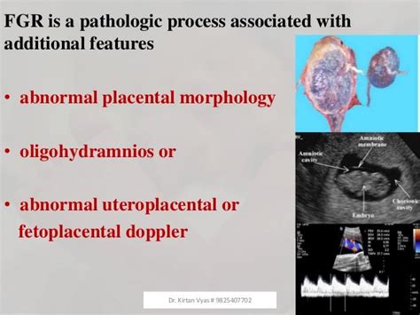 Fetal Growth Restriction