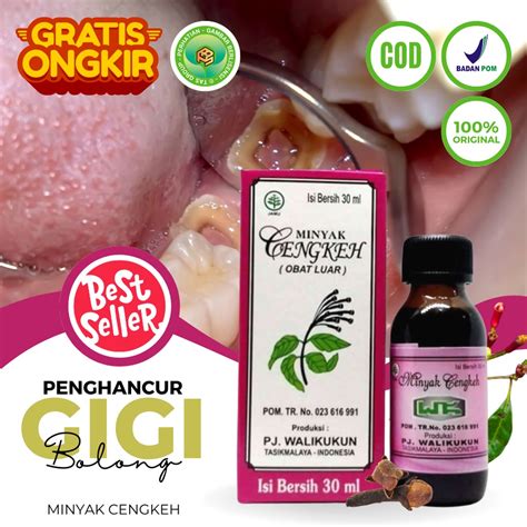 Jual Obat Sakit Gigi Berlubang Ampuh Minyak Cengkeh Murni Obat Sakit