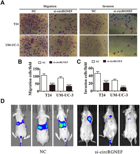 Circular RNA CircRGNEF Promotes Bladder Cancer Progression Via MiR 548