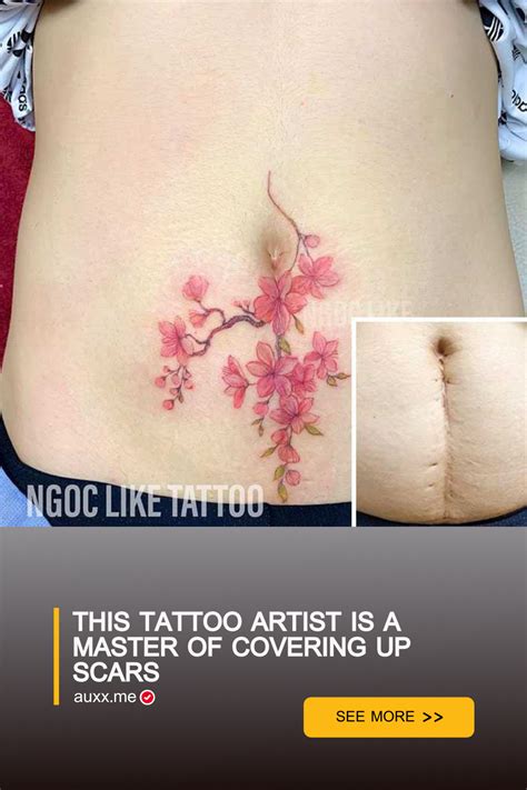 Transforming Scars Into Beautiful Art Meet The Master Tattoo Artist