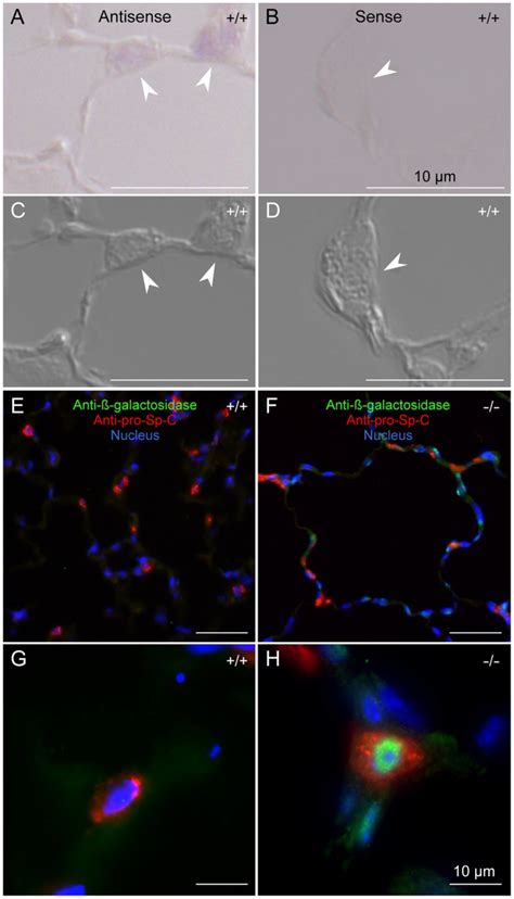 A And B In Situ Hybridization With Antisense And Sense Probes To