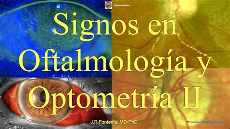 Clase De Signos En Oftalmolog A Y Optometr A Parte Ii Youtube