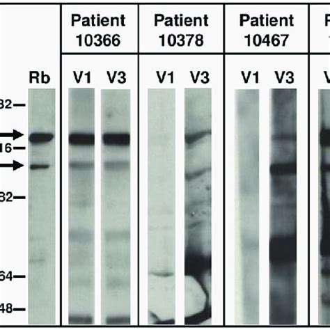 Immunoblot Igg Reactivity Of M Genitalium Positive Patient Sera With