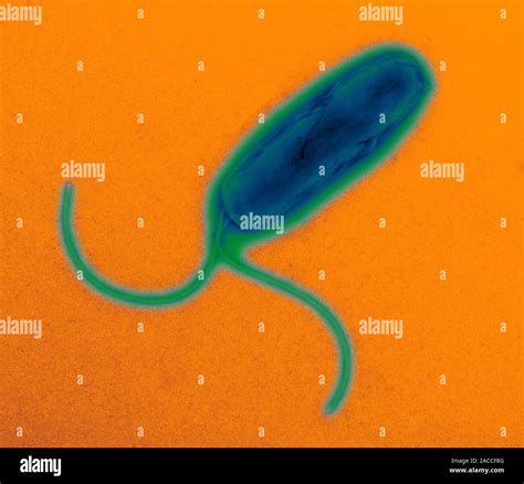 Helicobacter Pylori Bacterium Coloured Transmission Electron