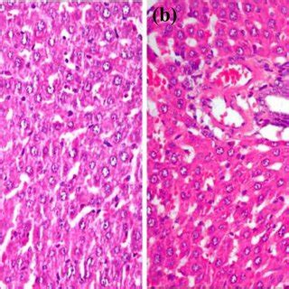 Histological Liver Section From Control Group Showing A Normal