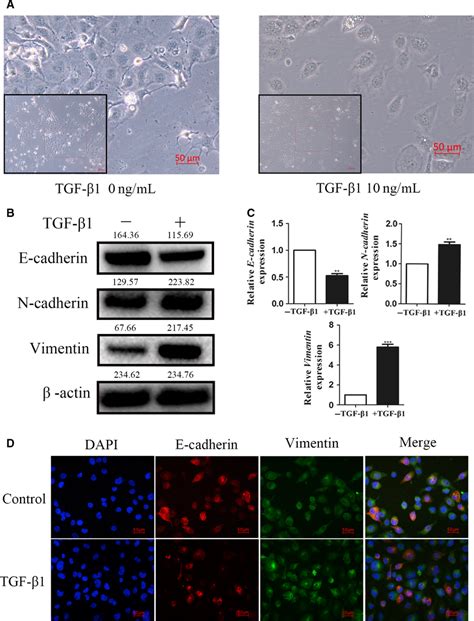 Tgf‐β Induces Emt In Escc Cells A Tgf‐β‐induced Cell Morphological