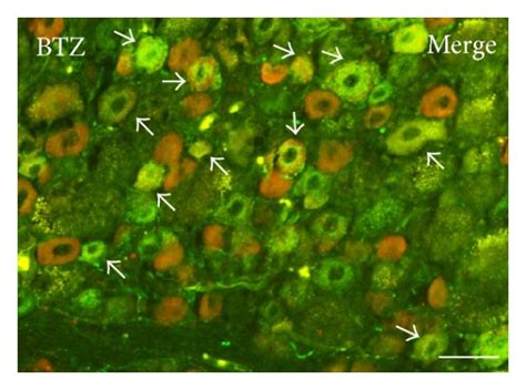 Double Labeling Immunofluorescence For Trpv Cgrp Ac And Df And