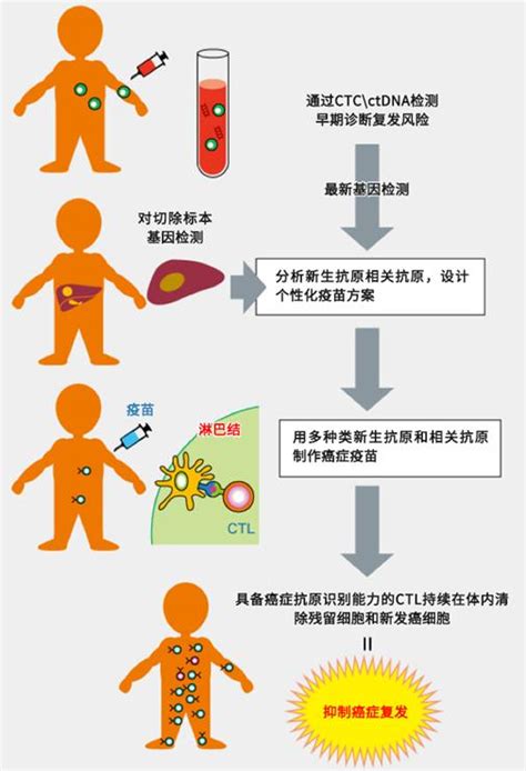 个性化癌症免疫疗法的前景 日本劳动厚生省认定【日本就医网】