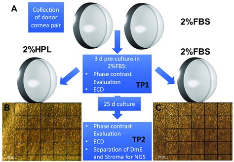 A Experimental Workflow The 32 Corneas 16 Pairs From 16 Donors