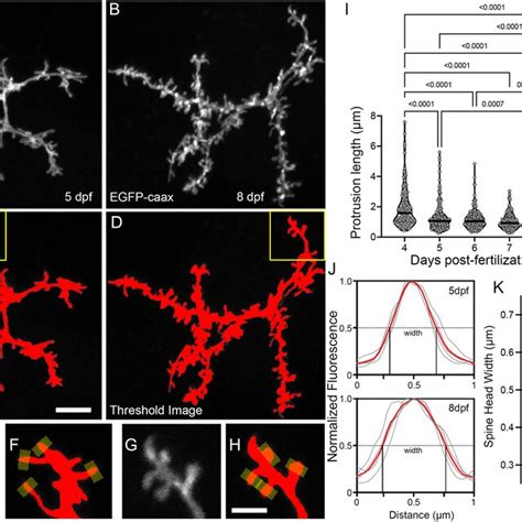 Morphological Changes Associated With The Filopodia Spine Transition