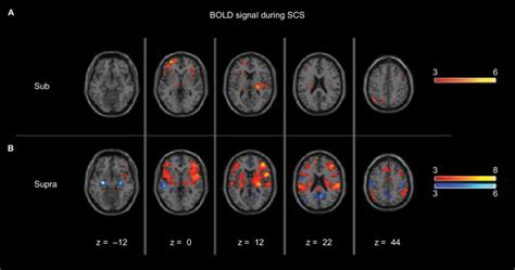 Group Average Activation Maps Of Functional Bold Alterations During Download Scientific Diagram