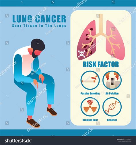 Lung Cancer Risk Factors