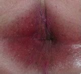 Prurito Anal Cirug A Colorrectal Proct Logo