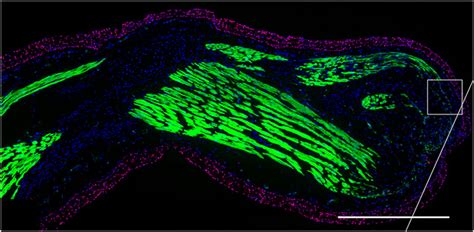 Regeneration What Does It Mean And How Does It Work Eurostemcell