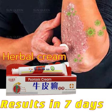 Natural Chinese Herb Herbal Medicine Psoriasis Eczema Ointment