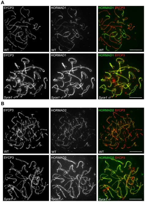 Sc Formation Is Required For The Depletion Of Hormads From Chromosome