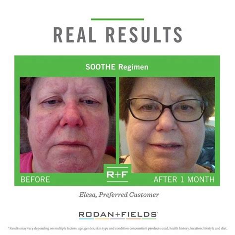 Soothe Redness And Calm Sensitive Skin Rodan And Fields