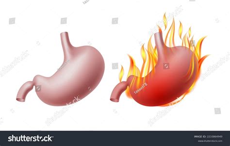 Stomach Burn Concept Images Stock Photos Vectors Shutterstock