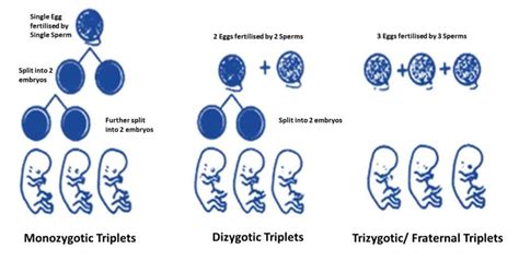 Identical Triplets, Myth or Reality! Can Triplets Be Identical ...