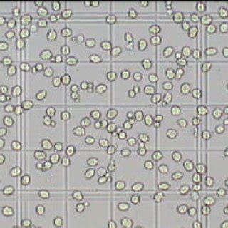 Total Platelet Count Using Neubauer Improved Haemocytometer With Low