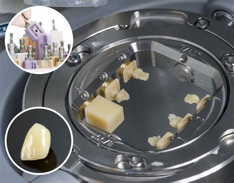 Ips Emax Cad Uk