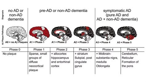 mesial temporal alzheimer disease ppptx