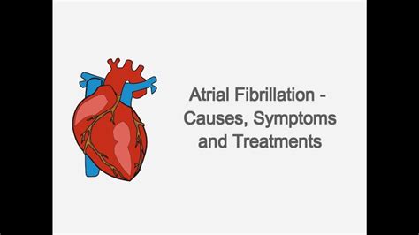 Atrial Fibrillation Afib Causes Symptoms And Treatments Youtube