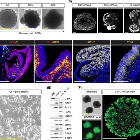 Characterization Of Cerebral Organoids And U Glioblastoma Cell Line