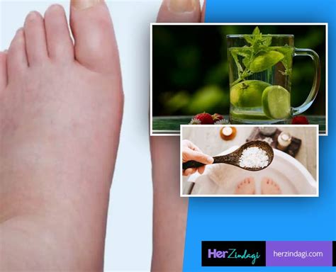 Home Remedies For Swollen Feet 48 Off