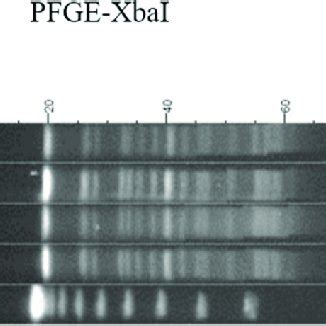 Result Of Pulsed Field Gel Electrophoresis And Dendrogram Of