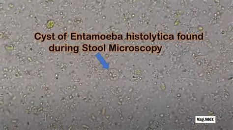 Entamoeba Histolytica Cyst